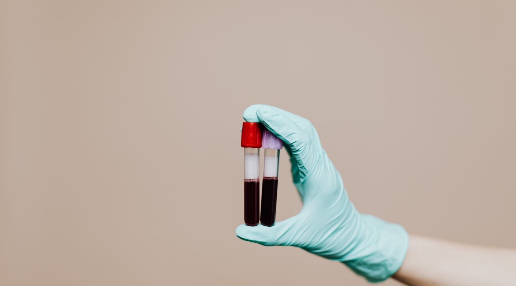 krew w moczu krwiomocz co oznacza